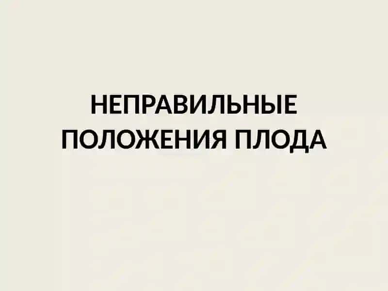 НЕПРАВИЛЬНЫЕ ПОЛОЖЕНИЯПЛОДА 2