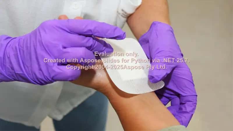 Wound management 2