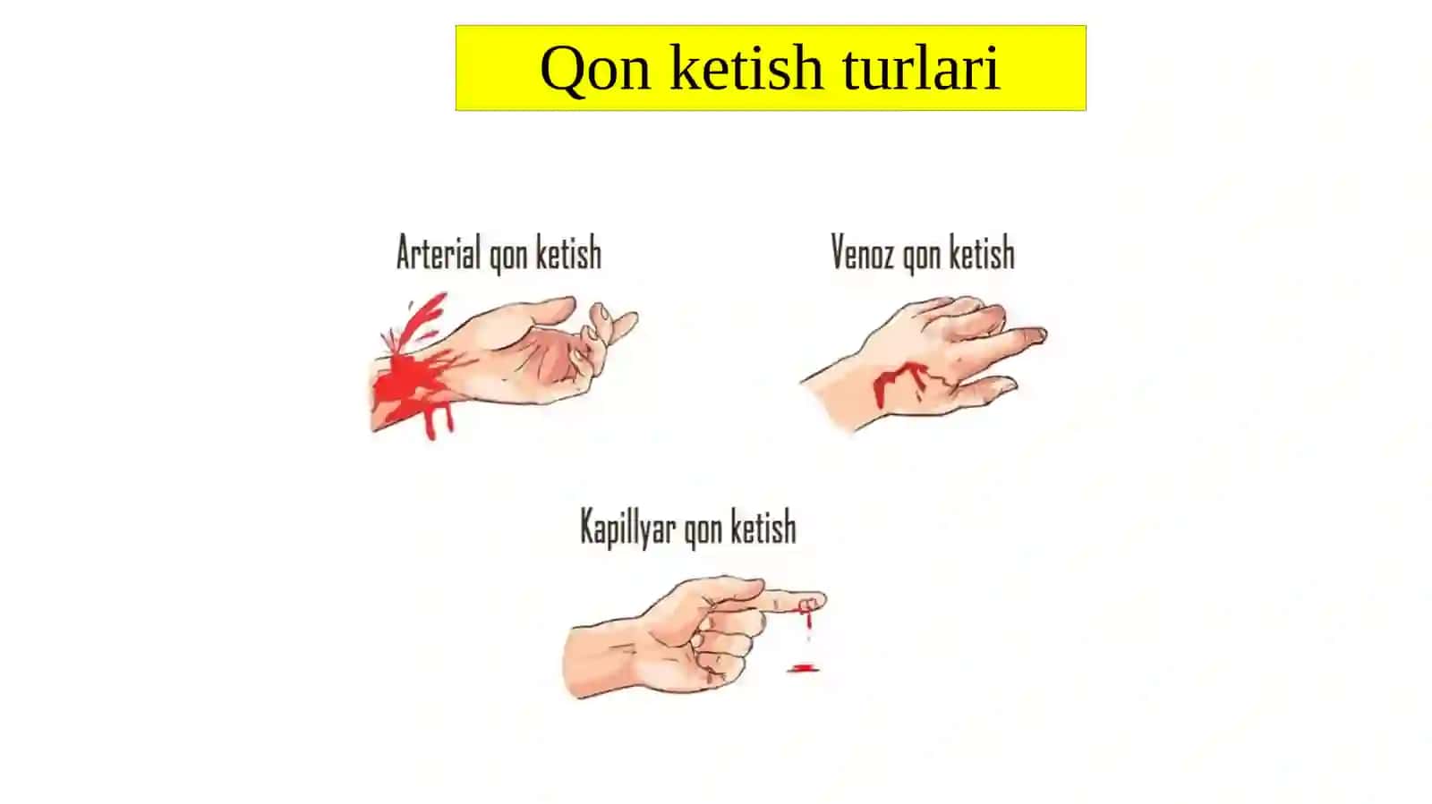 Qon ketishturlari 2