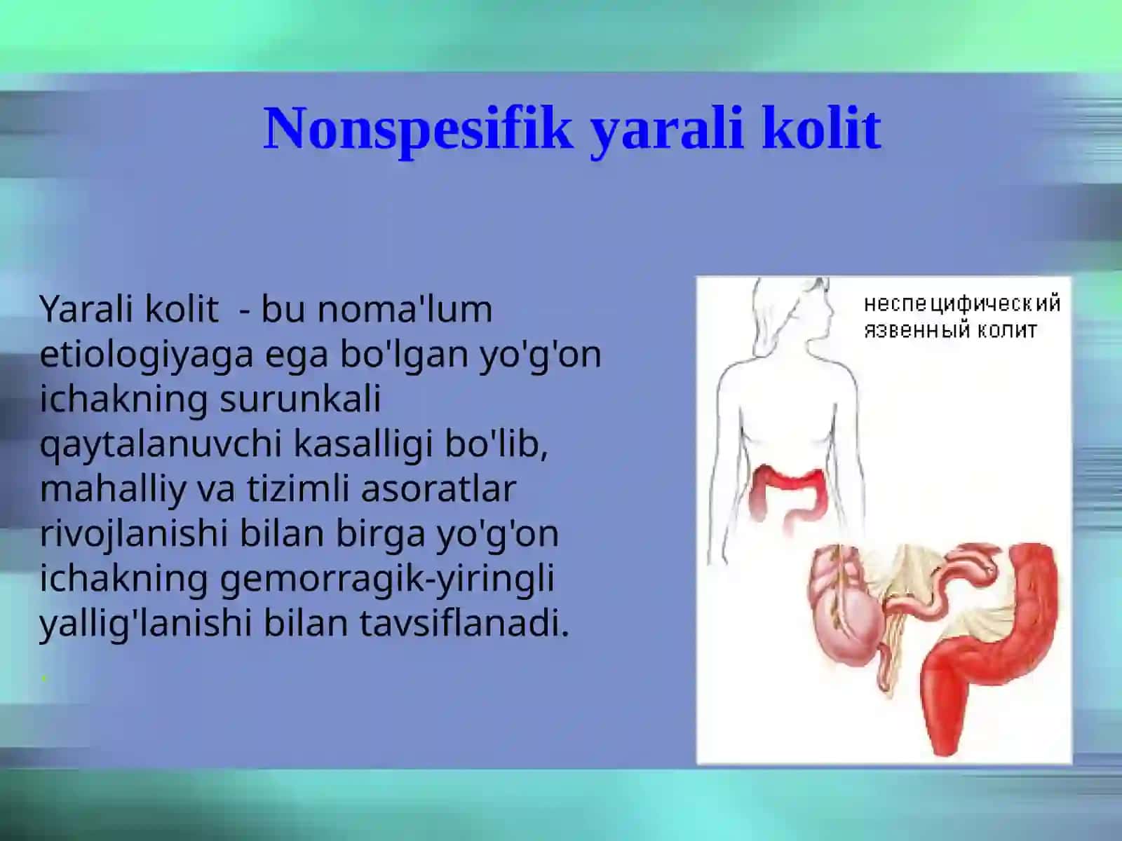 Nospesifikt yarali kolit 2