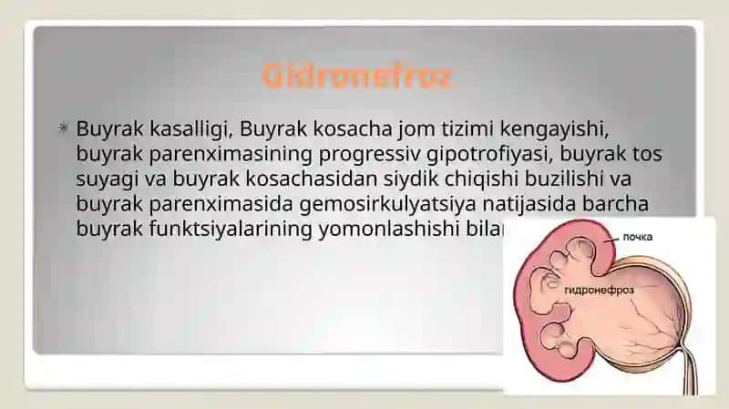 Gidronefroz 2
