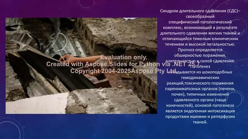 Синдром длительного сдавления (КРАШ-СИНДРОМ) 2