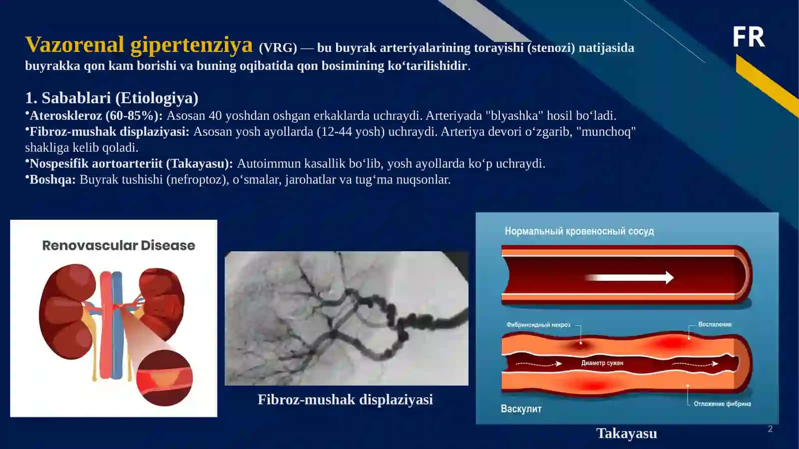 O‘tkir arterial tutilishi 2