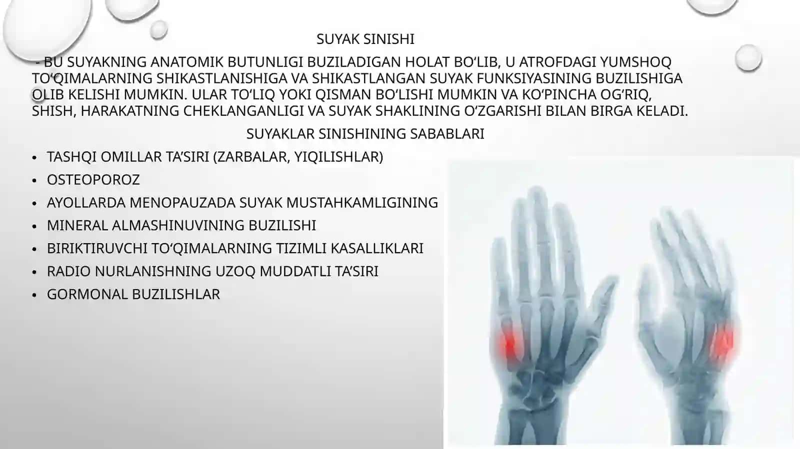 Suyaklarsinishinidavolashning yangi usullari 2