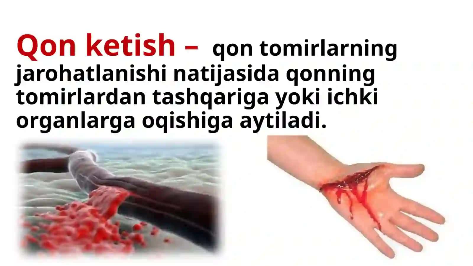 Tomirlardan qonketish 2