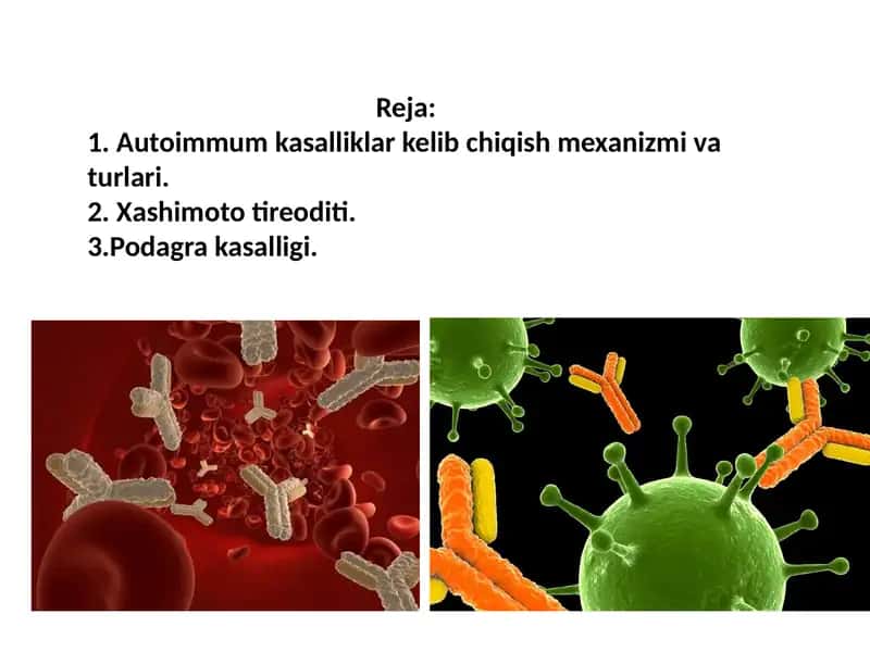 Autoimmun kasalliklar (mustaqil ish) 2