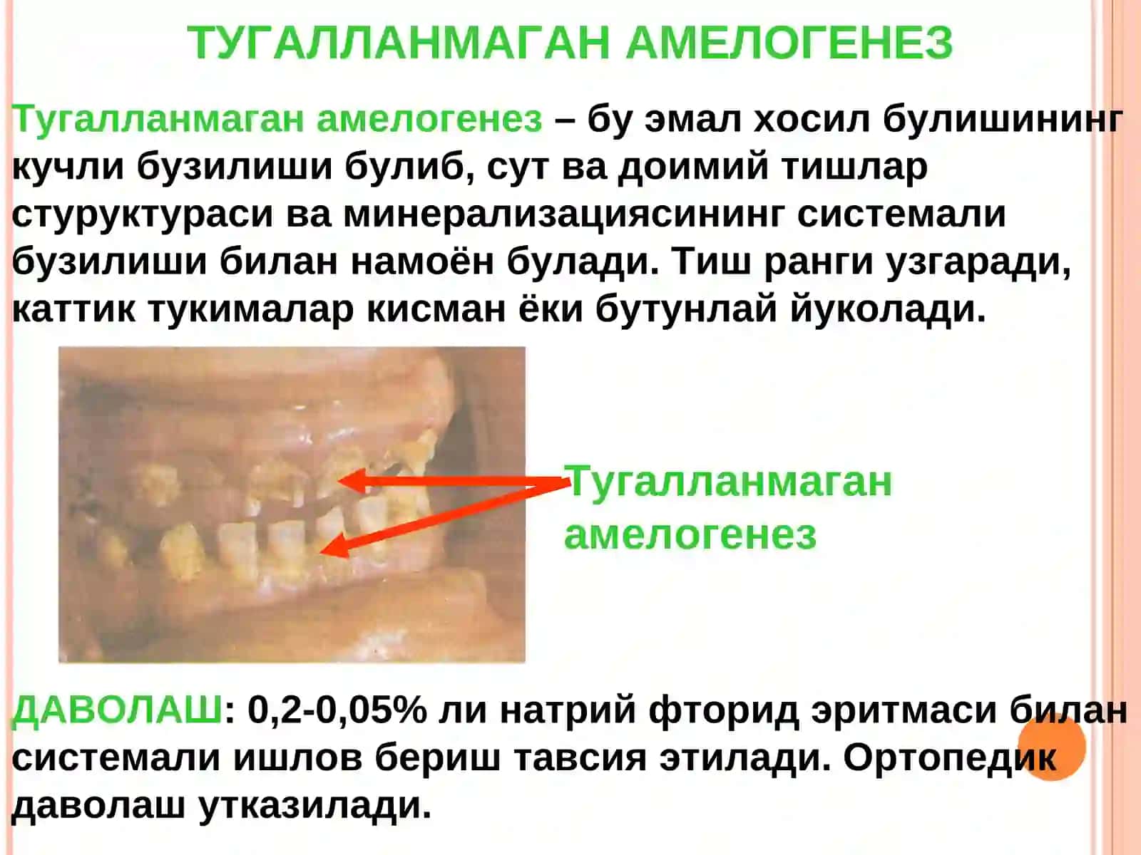 ТИШ РИВОЖЛАНИШИНГ НАСЛИЙ БУЗИЛИШИ 2