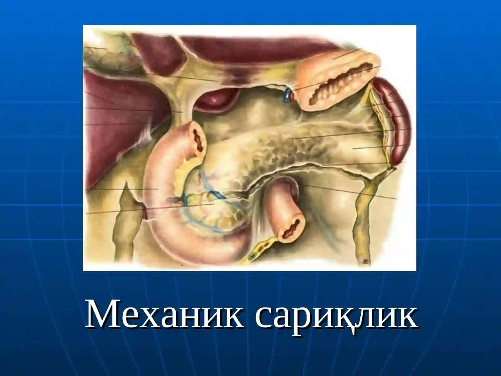 Mexanik sariqlik 2
