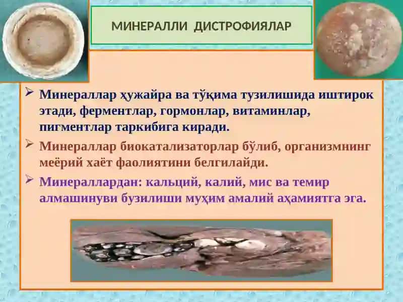 ПАТОЛОГИК АНАТОМИЯ КУРСИ 4 Маъруза 2