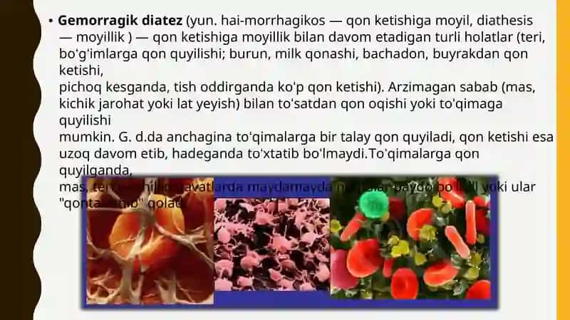 Gemoragik Diatezlar 2