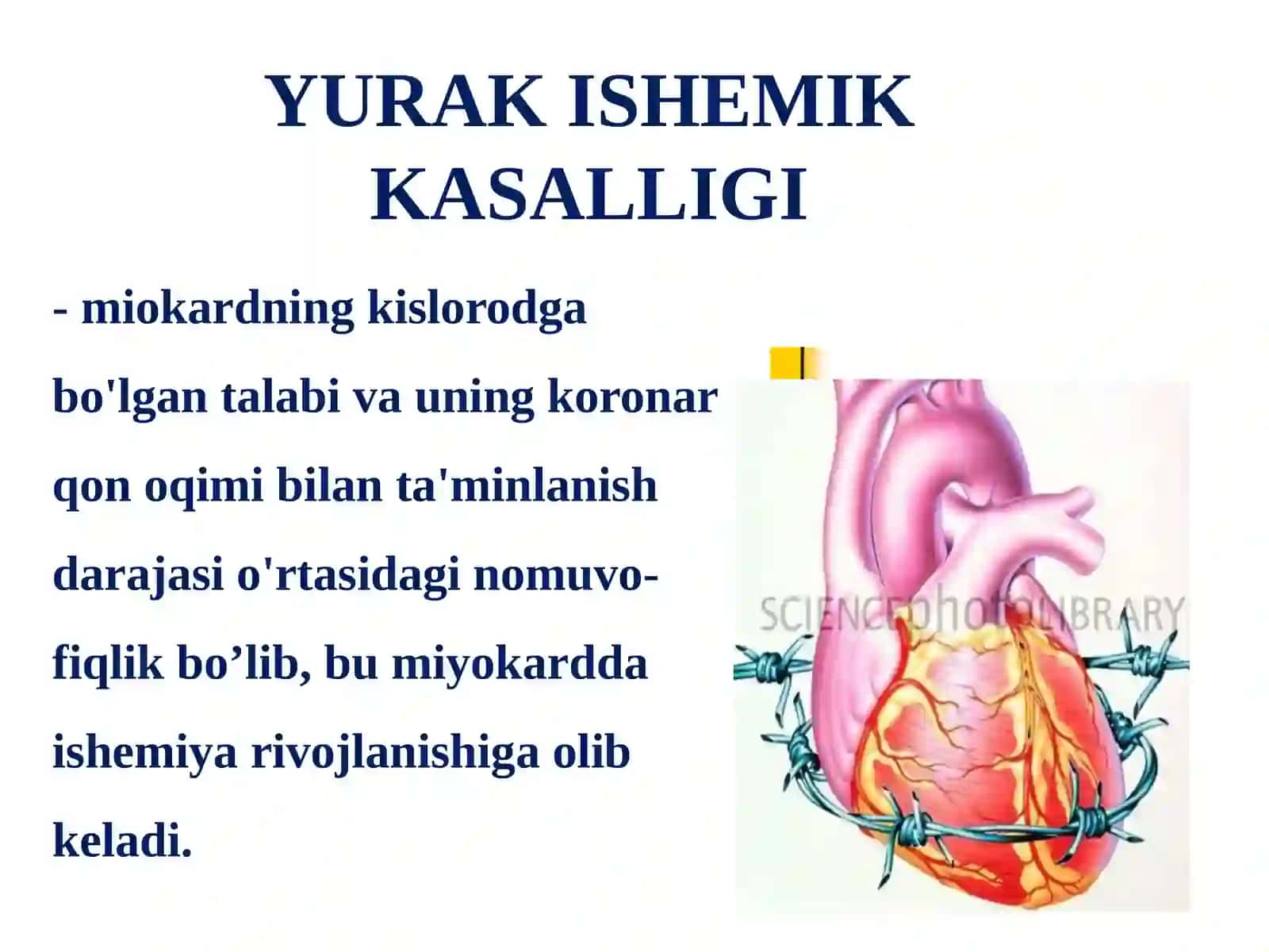 Yurak ishemik kasalligi 2