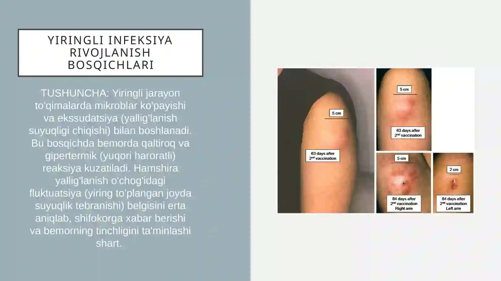 yiringli xirurgik bemorlar parvarishi 2