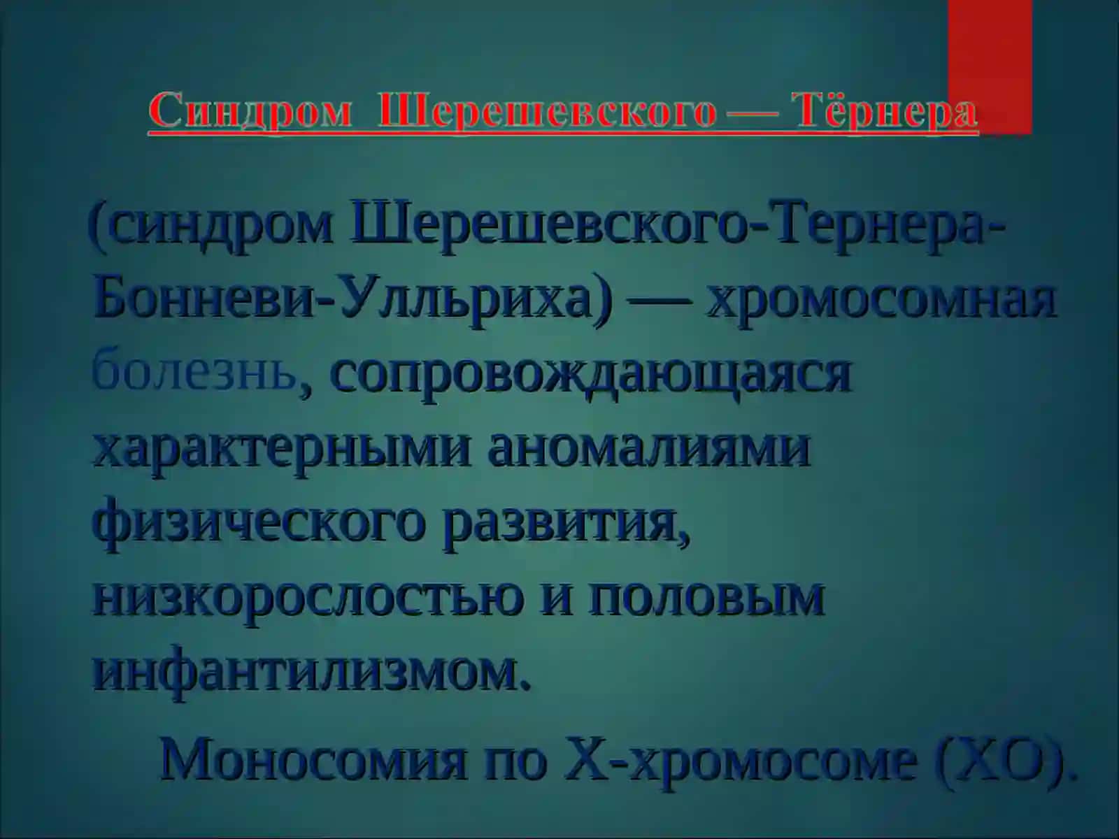 Синдром Шерешевского-Тернера-Бонневи-Улльриха 2
