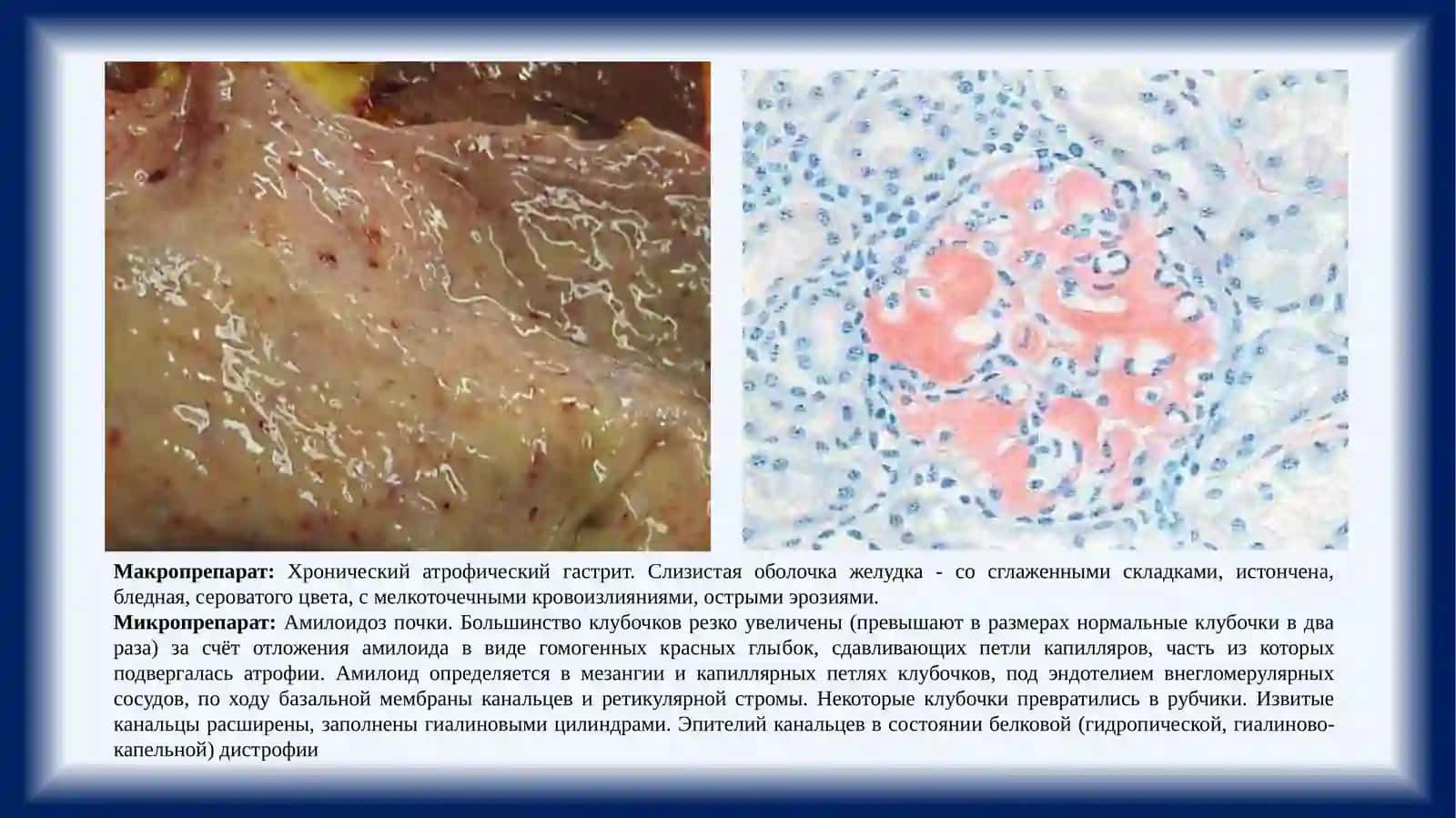 Макро и микропрепараты 2