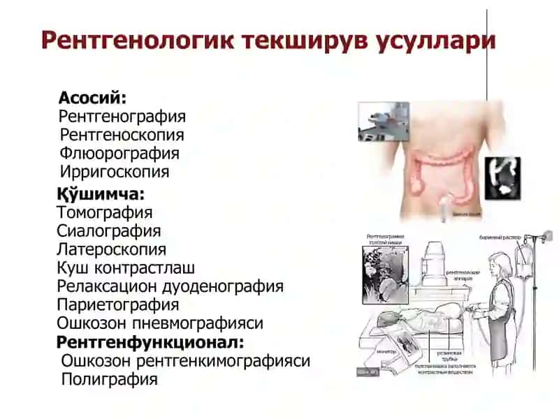 Ҳазм тизими аъзоларининг комплекс нур диагностикаси 2