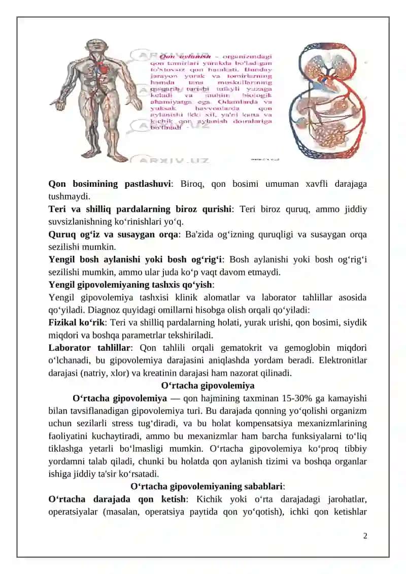 Yengil gipovolemiya 2