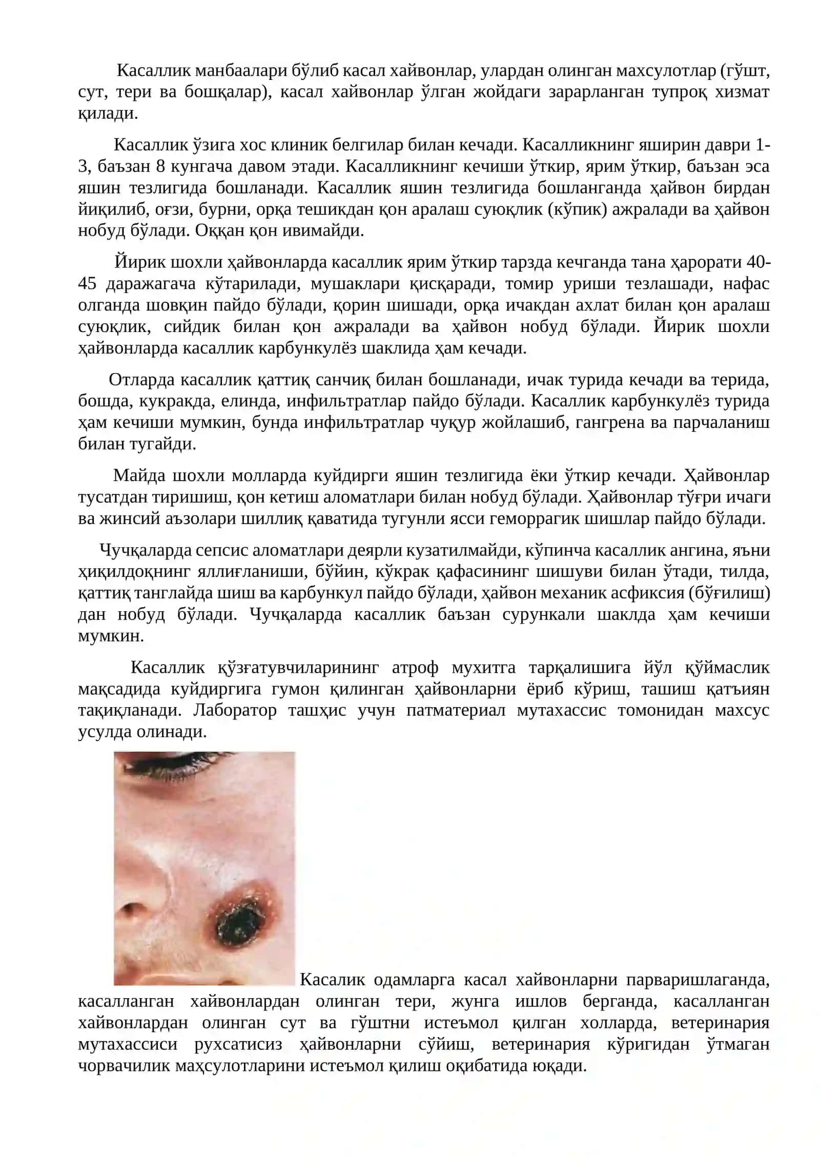 Куйдирги касаллиги ва унинг профилактикаси 2