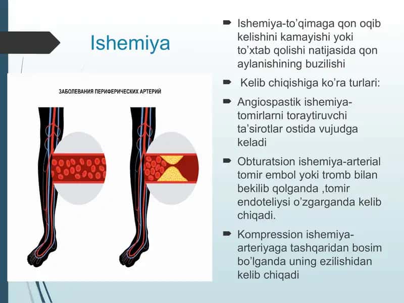Ishemiya 2