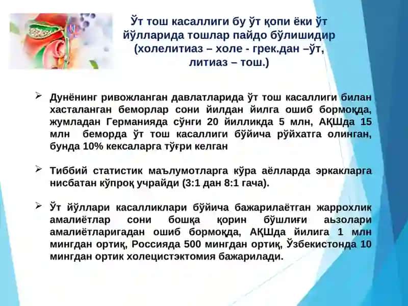 Ўт тош касаллиги 2