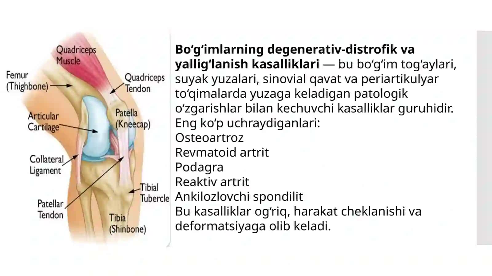 Boʻgimlarni distrofik degenerativ kasalliklari 2