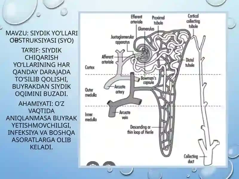 Siydik yo‘llari obstruksiyasi (SYO) 2