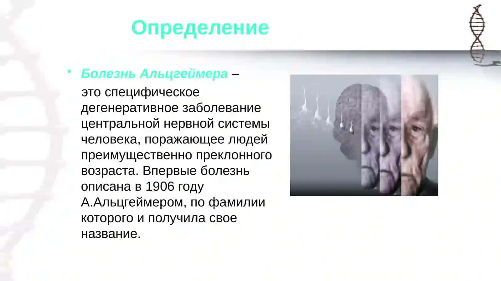 Болезнь Альцгеймера 2