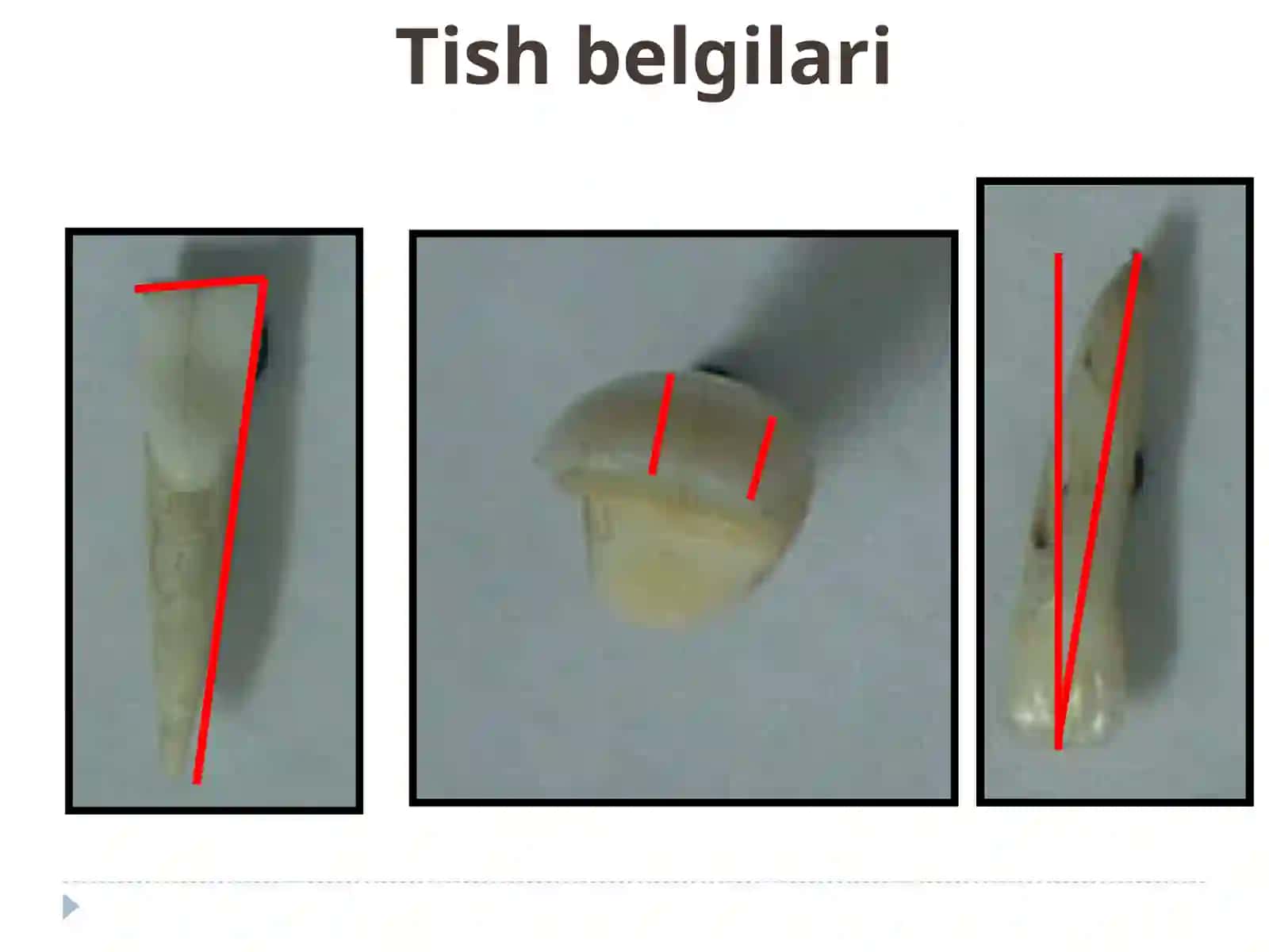 Sut tishlari xususiy anatomiyasi 2