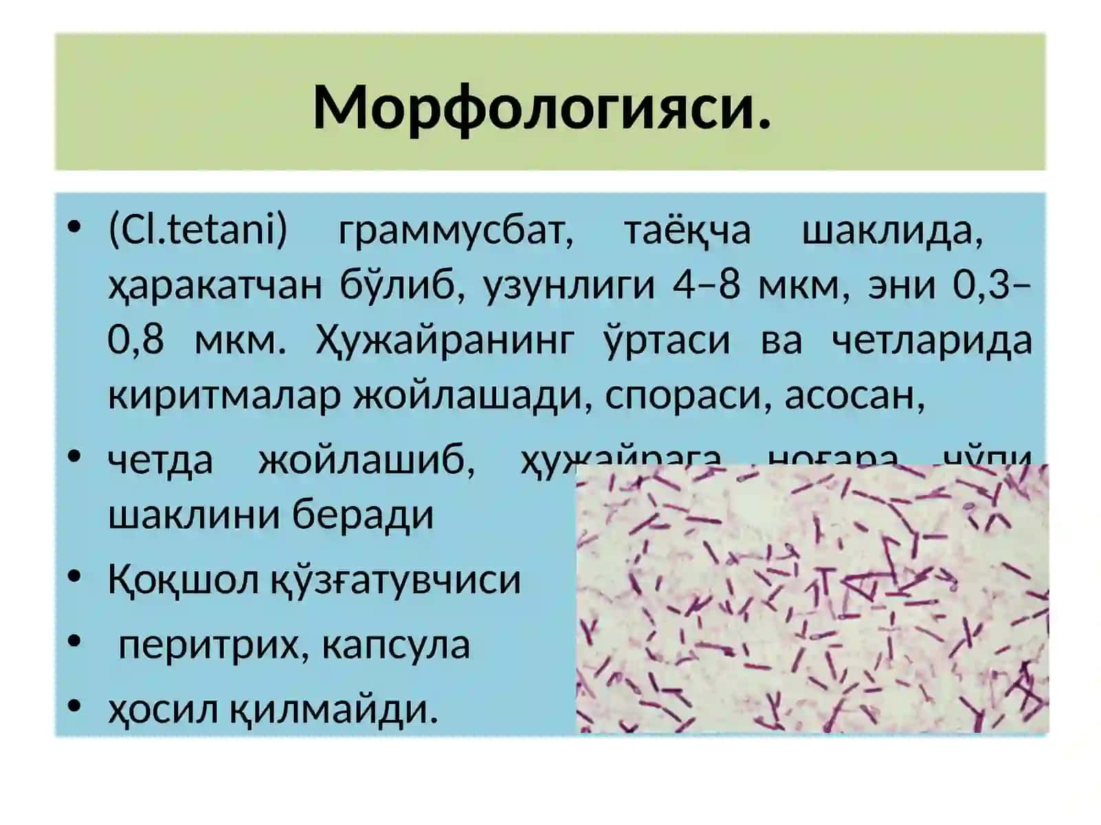 Қоқшолқўзғатувчиси 2