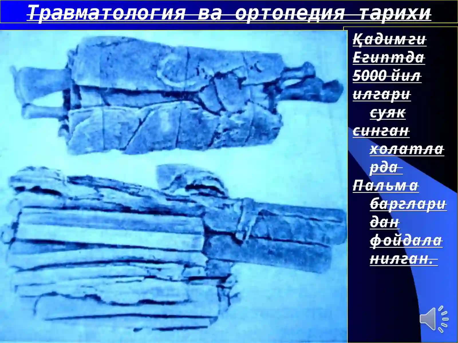 Травматология ва ортопедия 2