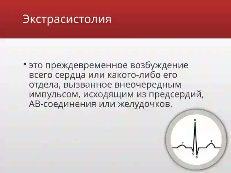 Ekstrasistoliya 2