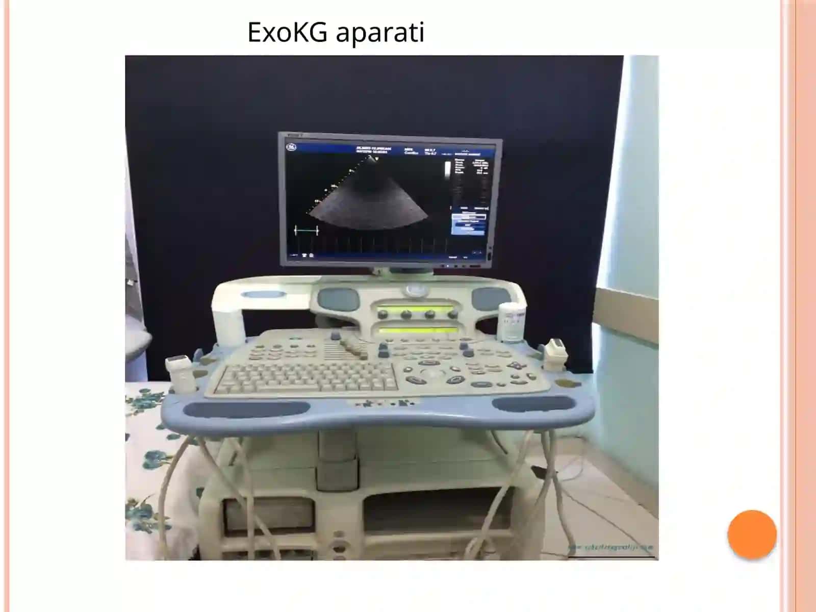 Yurakning ekokardiyografiyasi 2
