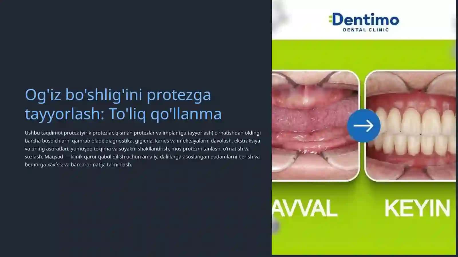 Og'iz bo'shlig'ini protezga tayyorlash 2
