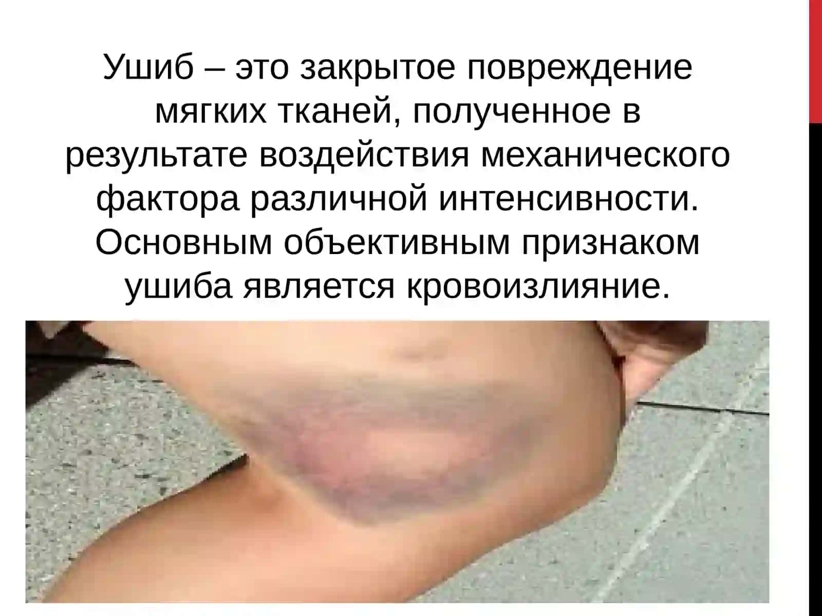 Травма 2