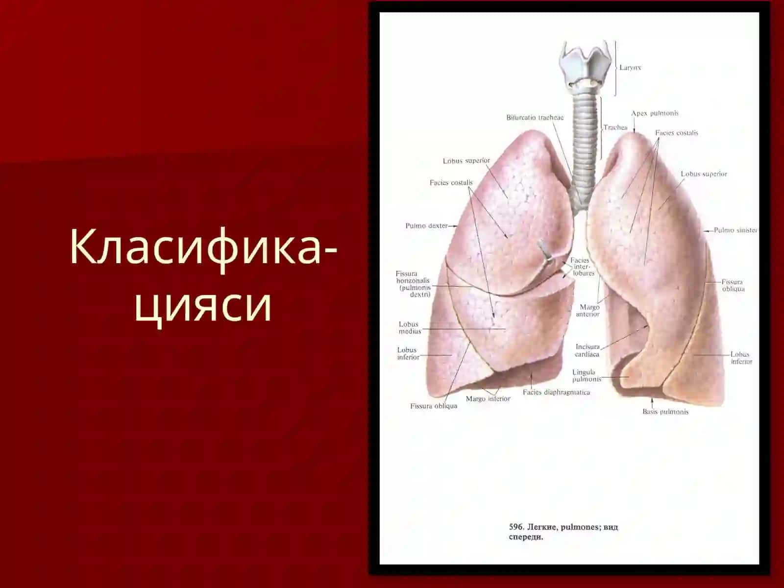 Ўпканинг хавфсиз ўсмалари ва кисталари Класифика-цияси 2