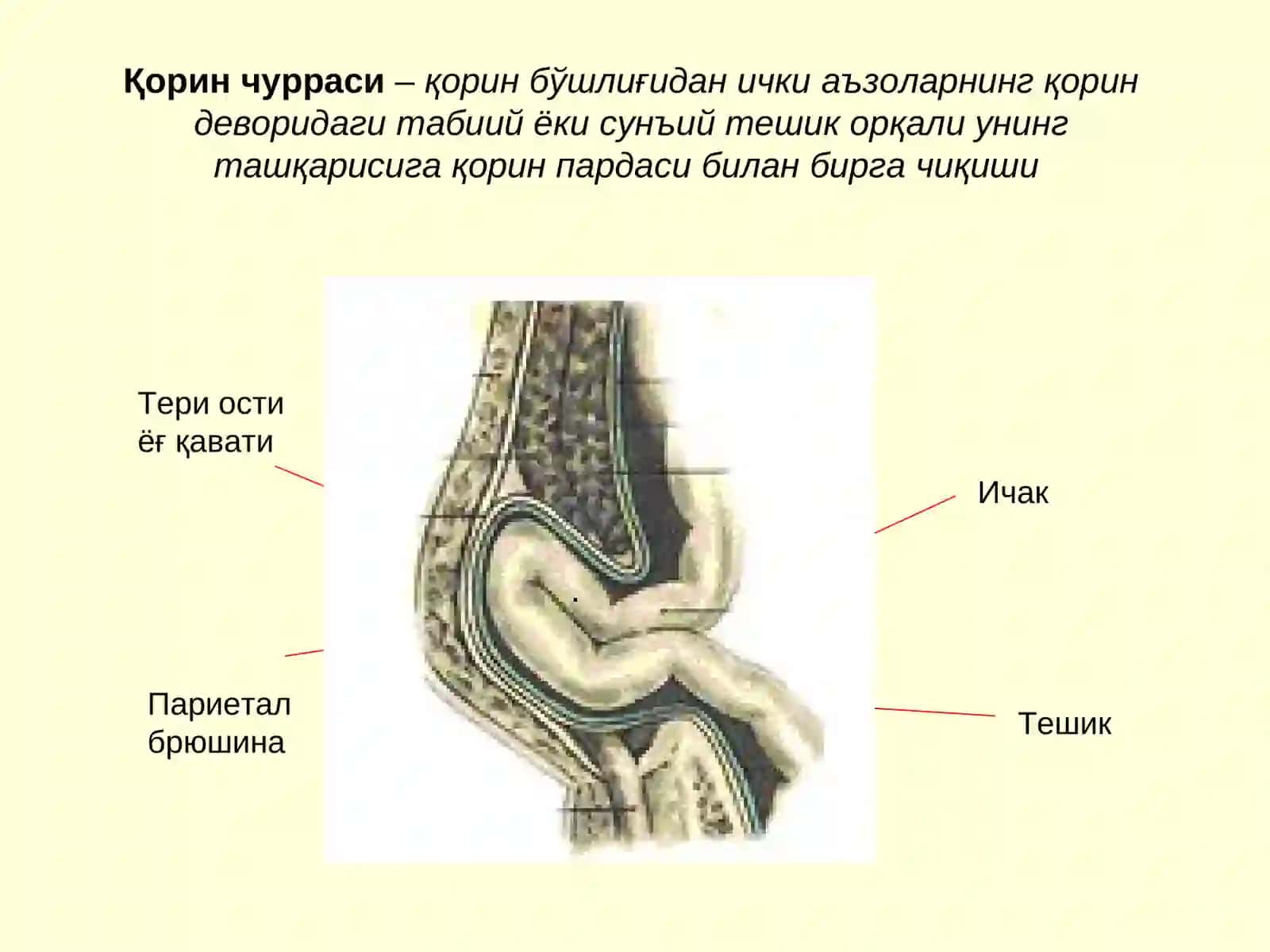 Қоринчурралари 2