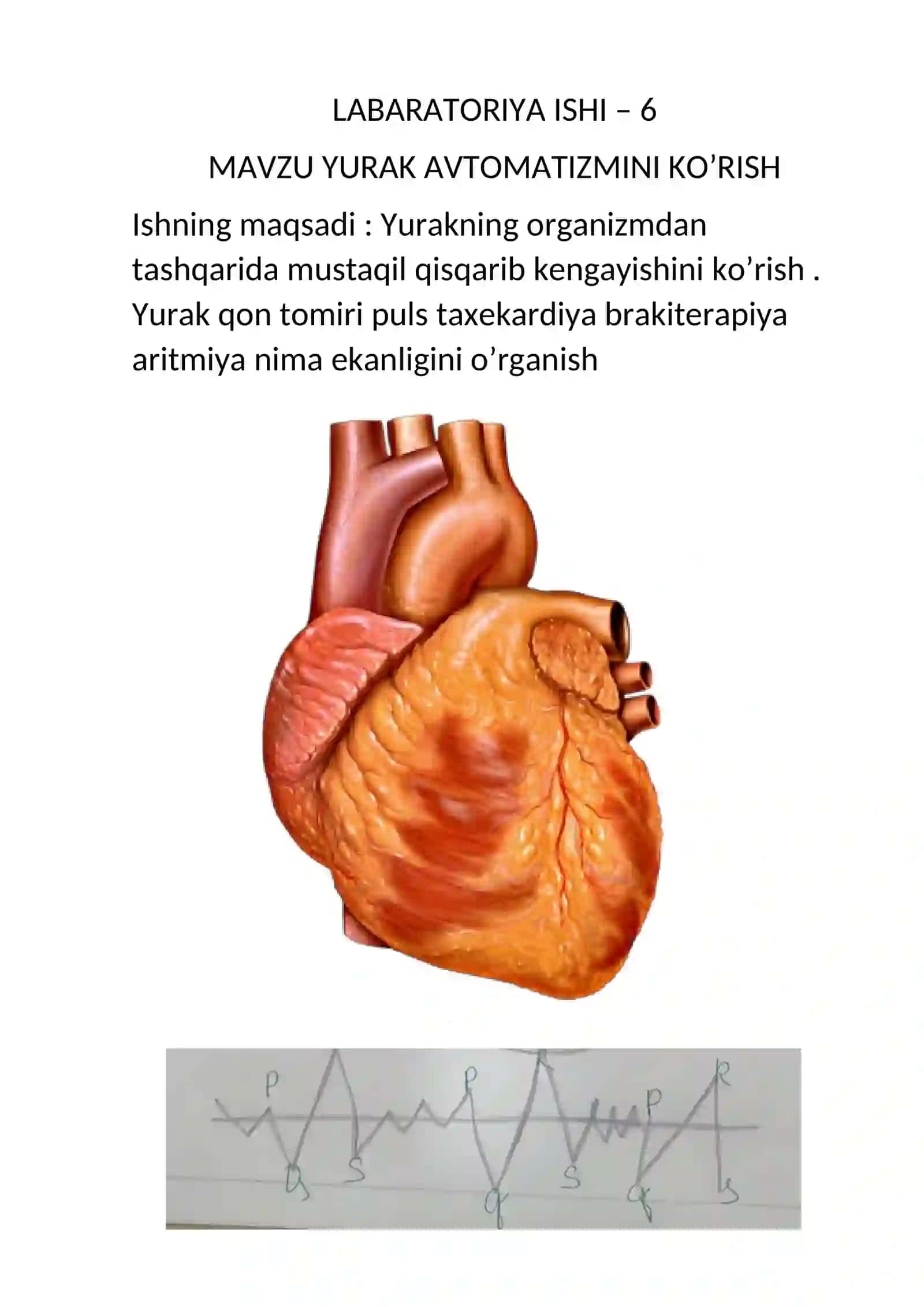YURAK AVTOMATIZMINI KO'RISH 2