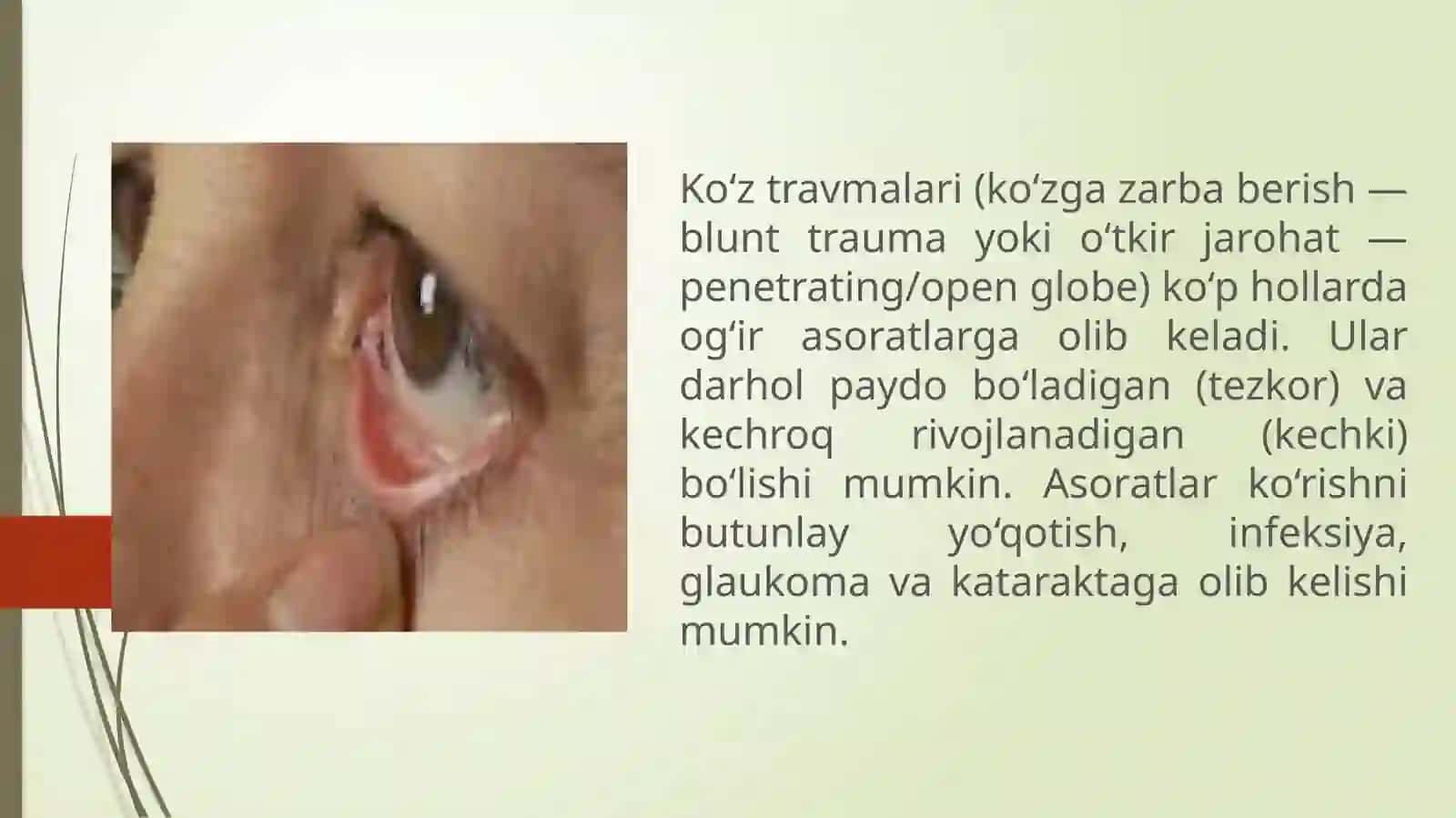 KO’Z TRAVMALARIDA ASORATLAR 2