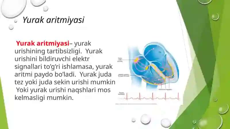 YurakaritmiyalariEKG diagnostikasi 2