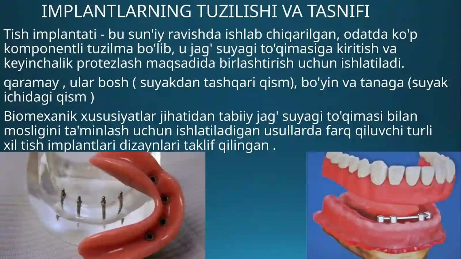 " Implantlardagi olinadigan protezlarni mahkamlash " 2