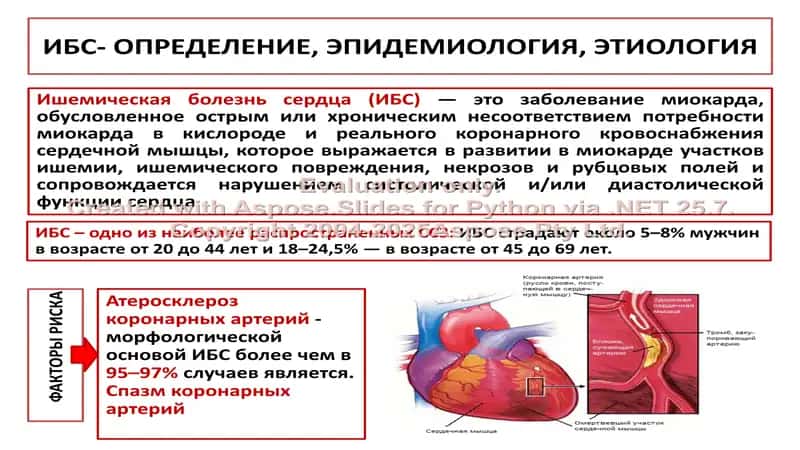 Ишемическая болезнь сердца 2