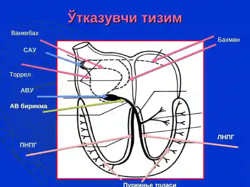 Болаларда аритмия 2