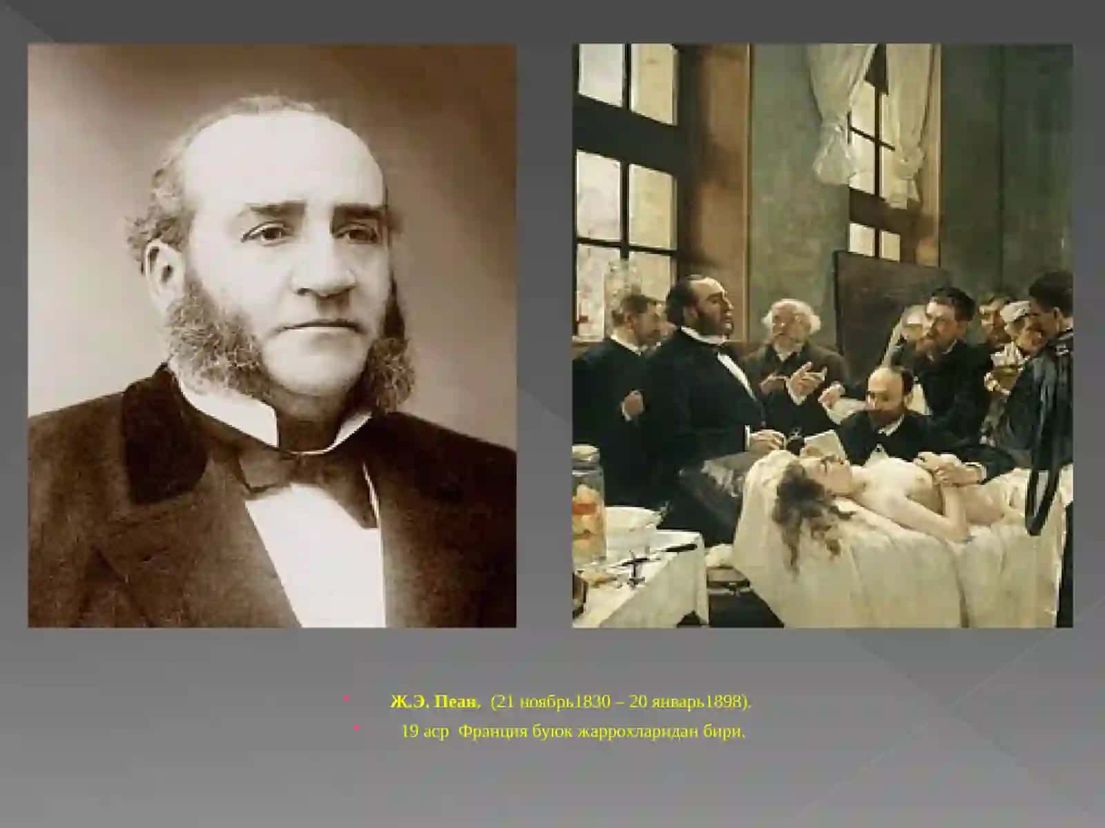 Меъда ва 12 бармокли ичак жаррохлигининг тарихий асослари 2