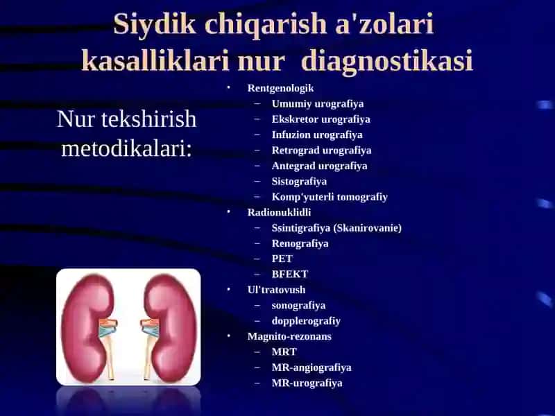 siydiq yo'llari kasalliklarining nur diagnostikasi 2