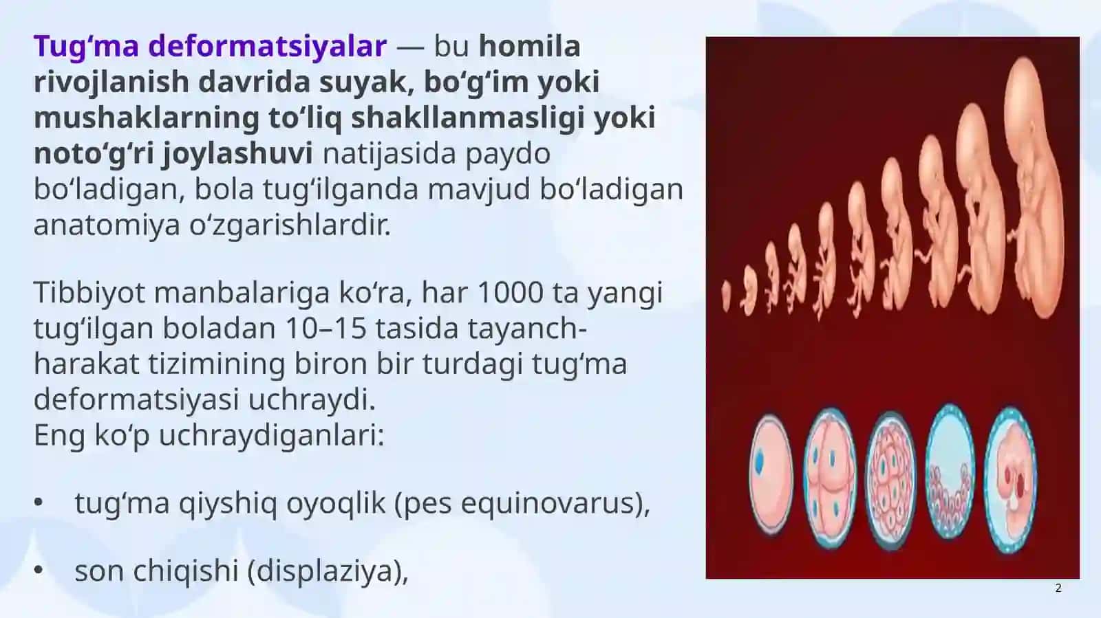 Tayanch-harakat tizimining tug‘ma deformatsiyalari 2