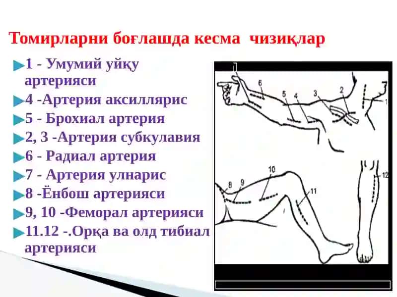 Томирларни боғлашда кесма чизиқлар 2
