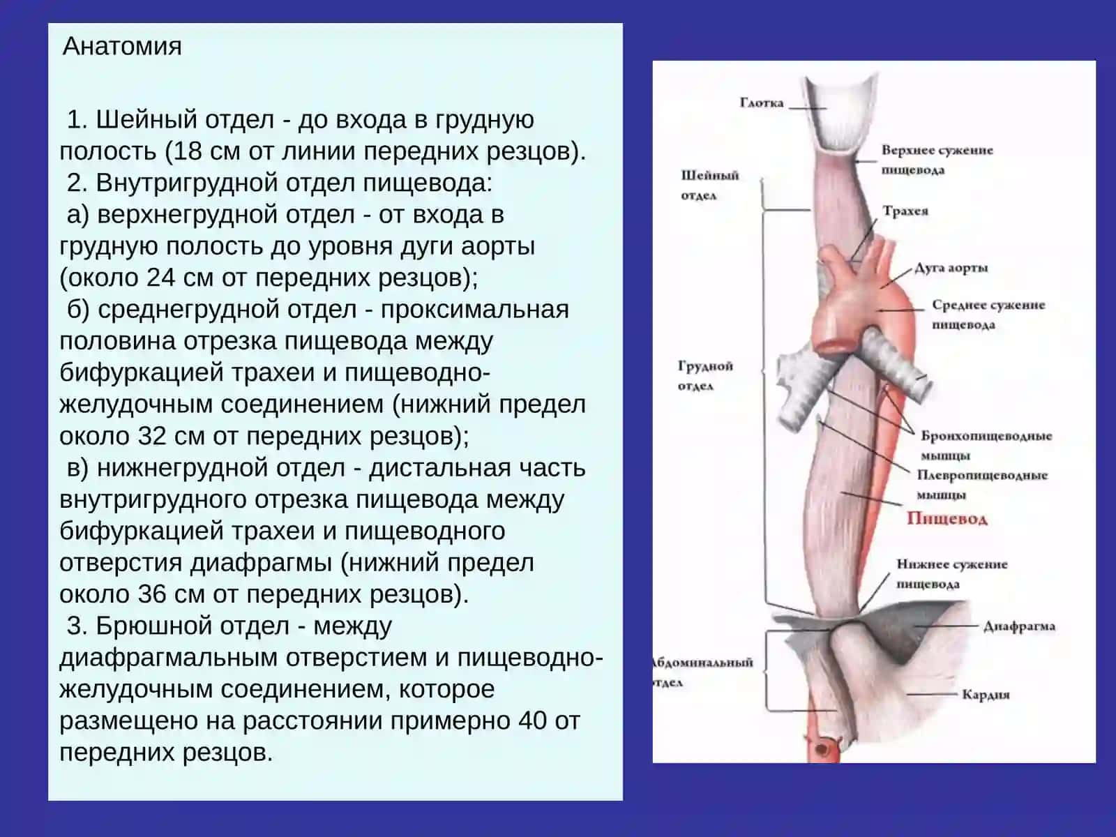 Рак пищевода 2