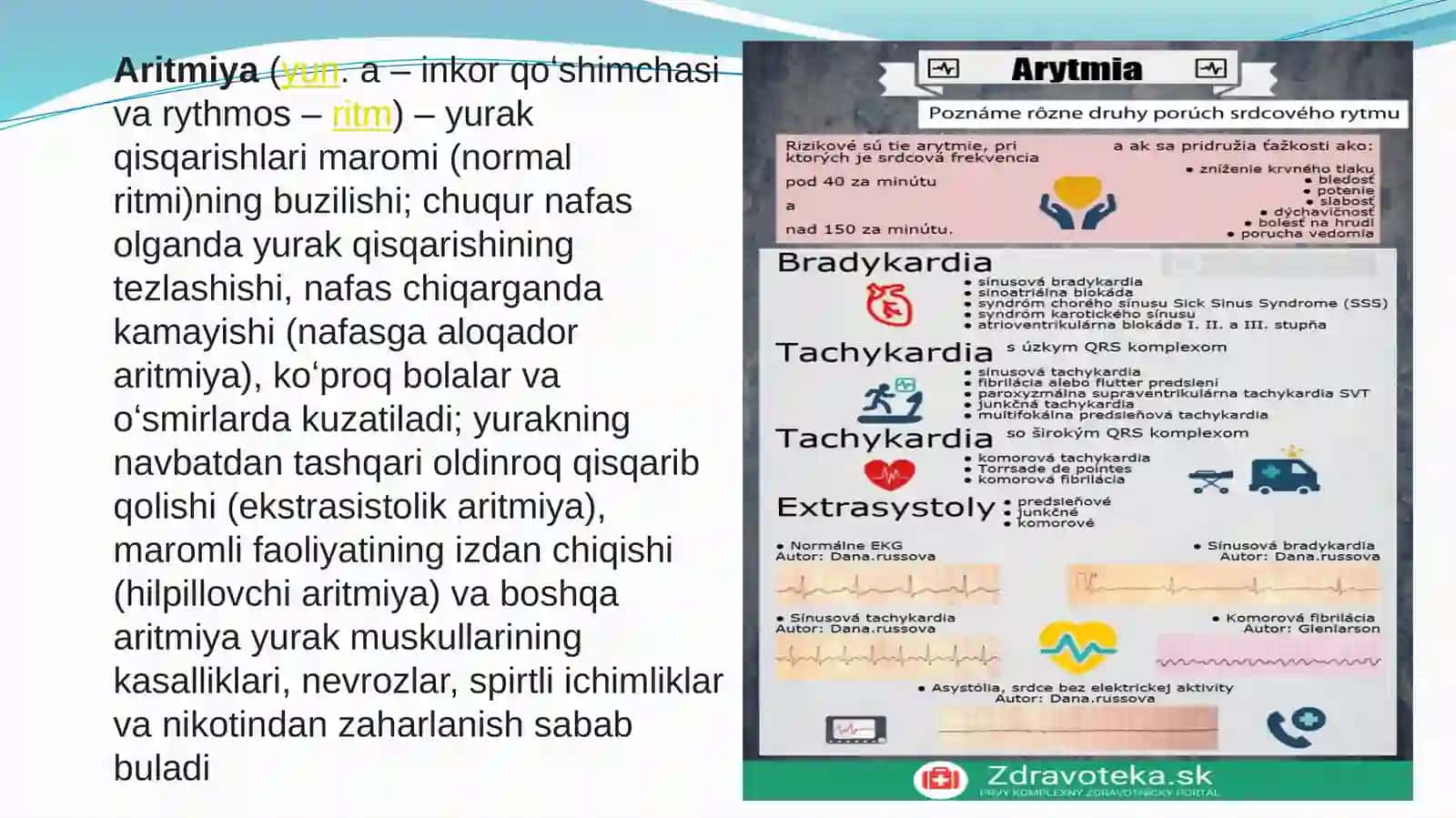 Aritmiyalarda EKG interpretatsiyasi 2