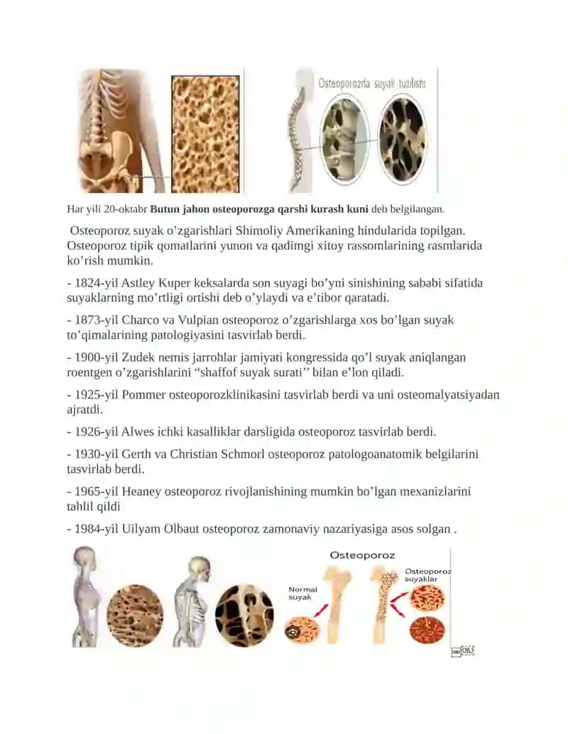 OSTEOPOROZ KELIB CHIQISH SABABLARI, ANIQLASH USULLARI, OLDINI OLISH YO’LLARI VA DAVOLASH CHORALARI 2