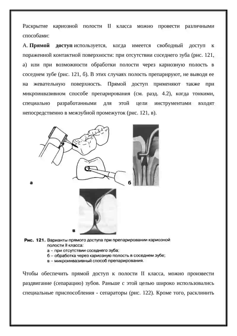 Полость II класса 2