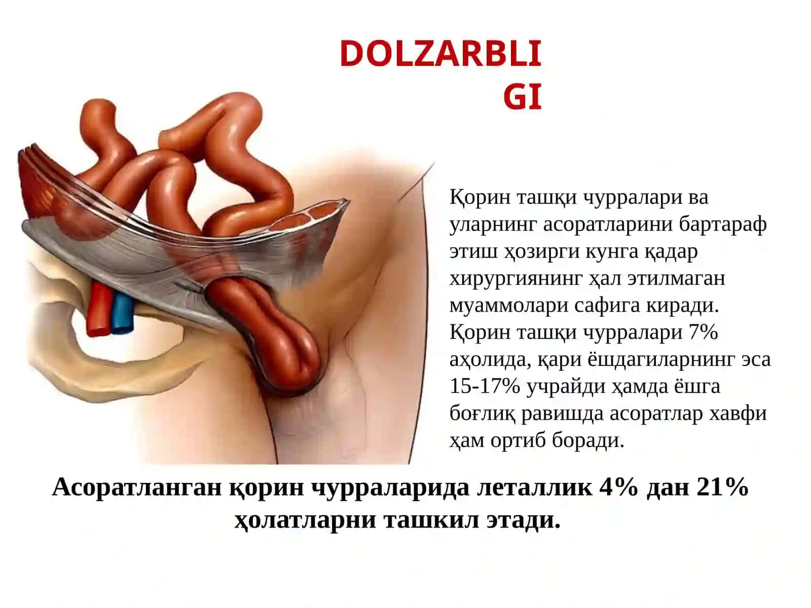 Qorin Churralari Va Ularning Asoratlari 2